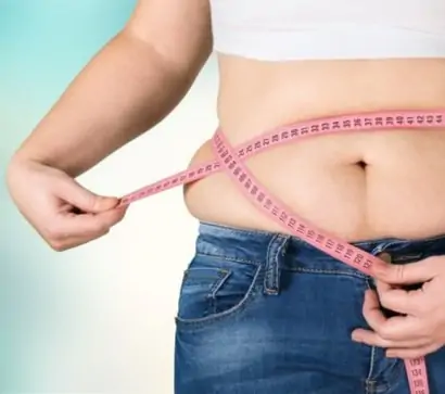 Obesity