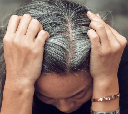 Premature Greying